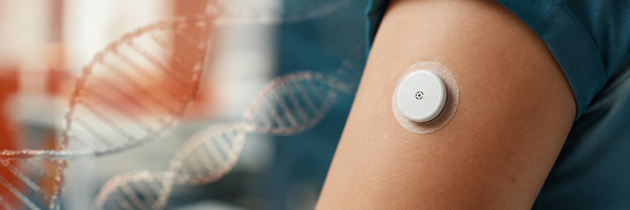 CGM-A1c Genetics study